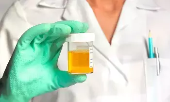 Kidneys: మూత్ర పోసేటప్పుడు నురుగు వస్తుందా? అయితే ఈ వ్యాధి..