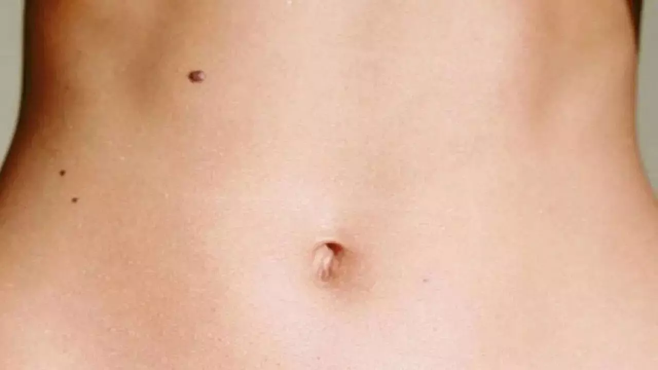 Moles: పొట్టలో ఈ భాగంలో పుట్టుమచ్చ ఉందా..? మీకంటే అదృష్టవంతులు మరొకరు ఉండరు Moles: పొట్టలో ఈ భాగంలో పుట్టుమచ్చ ఉందా..? మీకంటే అదృష్టవంతులు మరొకరు ఉండరు