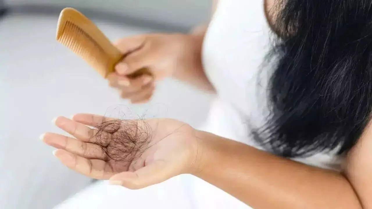 Hair Fall: నీరు మారితే జుట్టు రాలుతుందా? ఈ విషయాలు తప్పక తెలుసుకోండి.. Hair Fall: నీరు మారితే జుట్టు రాలుతుందా? ఈ విషయాలు తప్పక తెలుసుకోండి..