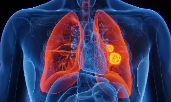 Damage Your Lungs: ధూమపానం మాత్రమే కాదు.. ఊపిరితిత్తులను దెబ్బతీసేవి ఇవే.