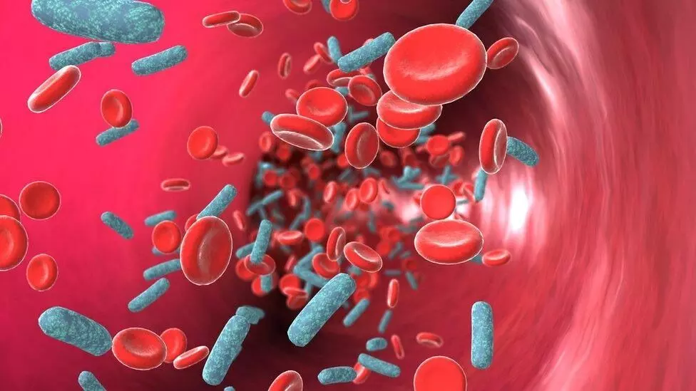 Blood Infection: బ్లడ్ ఇన్ఫెక్షన్ ఎందుకు అవుతుంది..లక్షణాలేంటి.? Blood Infection: బ్లడ్ ఇన్ఫెక్షన్ ఎందుకు అవుతుంది..లక్షణాలేంటి.?