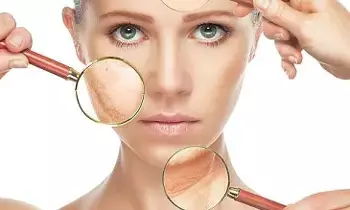 Collagen — The Secret to Glowing Skin: మెరిసే చర్మానికి ఆధారం కొల్లాజెన్.. వయసు పెరిగే కొద్దీ ఎందుకంత కీలకం? Collagen — The Secret to Glowing Skin: మెరిసే చర్మానికి ఆధారం కొల్లాజెన్.. వయసు పెరిగే కొద్దీ ఎందుకంత కీలకం?