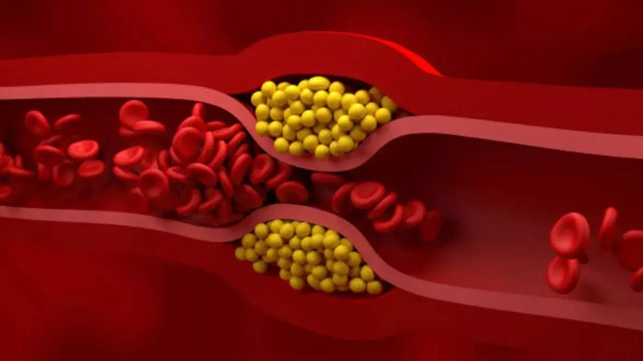 Reduce Your Bad Cholesterol in Just 3 Months: ఇవి తింటే 3 నెలల్లోనే మీ చెడు కొలెస్ట్రాల్ను తగ్గుతుంది.. Reduce Your Bad Cholesterol in Just 3 Months: ఇవి తింటే 3 నెలల్లోనే మీ చెడు కొలెస్ట్రాల్ను తగ్గుతుంది..