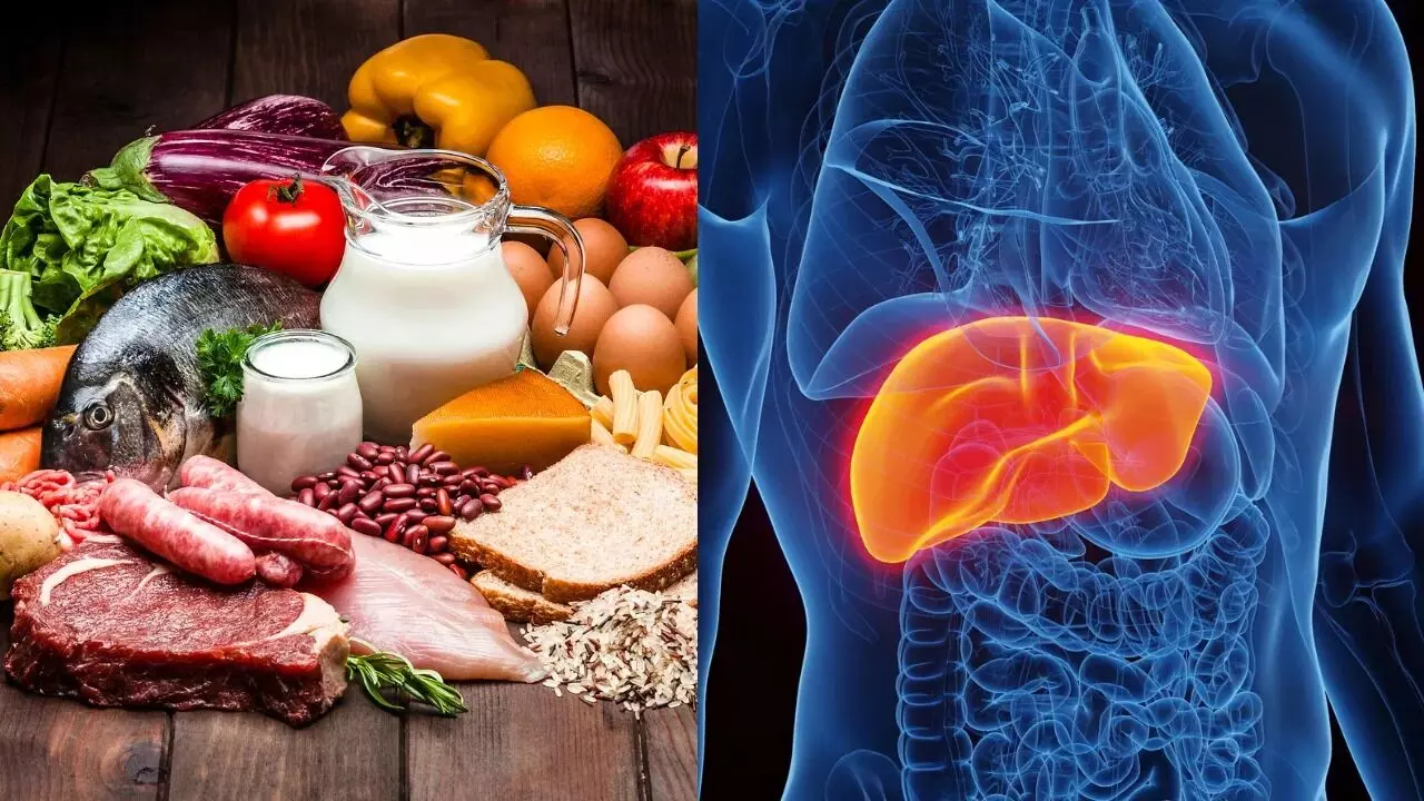 Fatty Liver: ఫ్యాటీ లివర్ ఉన్నవారు ఈ 5 ఫుడ్స్ అస్సలు తినొద్దు Fatty Liver: ఫ్యాటీ లివర్ ఉన్నవారు ఈ 5 ఫుడ్స్ అస్సలు తినొద్దు