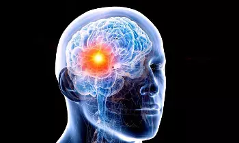 3 Night-Time Sleep Symptoms: రాత్రిపూట నిద్రలో కనిపించే ఈ 3 లక్షణాలను ఎప్పుడూ లైట్ తీసుకోవద్దు.. 3 Night-Time Sleep Symptoms: రాత్రిపూట నిద్రలో కనిపించే ఈ 3 లక్షణాలను ఎప్పుడూ లైట్ తీసుకోవద్దు..
