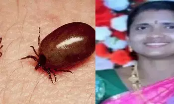 ఆంధ్రప్రదేశ్‌లో స్క్రబ్ టైఫస్ కలవరం.. చిత్తూరు, కాకినాడ, విశాఖ జిల్లాలు అత్యధికంగా బాధితం – ఇప్పటివరకు 1317 కేసులు నమోదు, ఒక మరణం