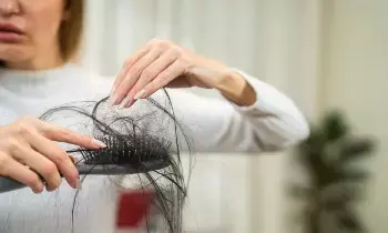 Reduce Hair Fall: ఈ ఆహారాలకు దూరంగా ఉండటం వల్ల జుట్టు రాలడం తగ్గుతుంది..