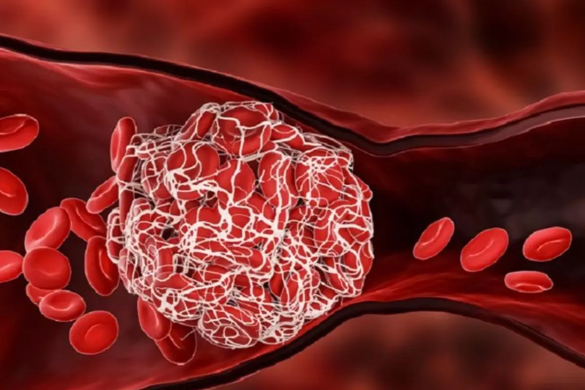 Bilirubin Levels Increase in the Blood: రక్తంలో బిలిరూబిన్ పెరిగితే ఏమవుతుంది? Bilirubin Levels Increase in the Blood: రక్తంలో బిలిరూబిన్ పెరిగితే ఏమవుతుంది?
