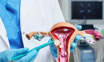 Fibroids in the Uterus: గర్భాశయంలో ఫైబ్రాయిడ్స్ ఉంటే ఏం చేయాలి.? Fibroids in the Uterus: గర్భాశయంలో ఫైబ్రాయిడ్స్ ఉంటే ఏం చేయాలి.?