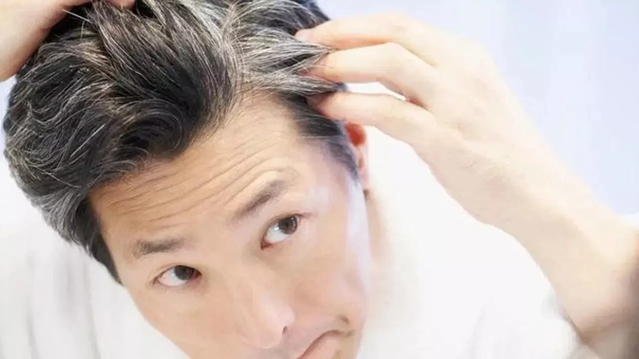 The Secret to Turning Grey Hair Black: తెల్ల జుట్టును నల్లగా మార్చే సీక్రెట్.. ఇంట్లోనే ఇలా చేస్తే చాలు.. The Secret to Turning Grey Hair Black: తెల్ల జుట్టును నల్లగా మార్చే సీక్రెట్.. ఇంట్లోనే ఇలా చేస్తే చాలు..