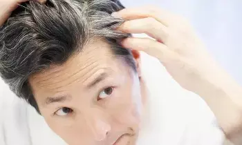 Hair Turns Grey at a Young Age: చిన్న వయసులోనే జుట్టు ఎందుకు తెల్లబడుతుందో తెలుసా.? Hair Turns Grey at a Young Age: చిన్న వయసులోనే జుట్టు ఎందుకు తెల్లబడుతుందో తెలుసా.?