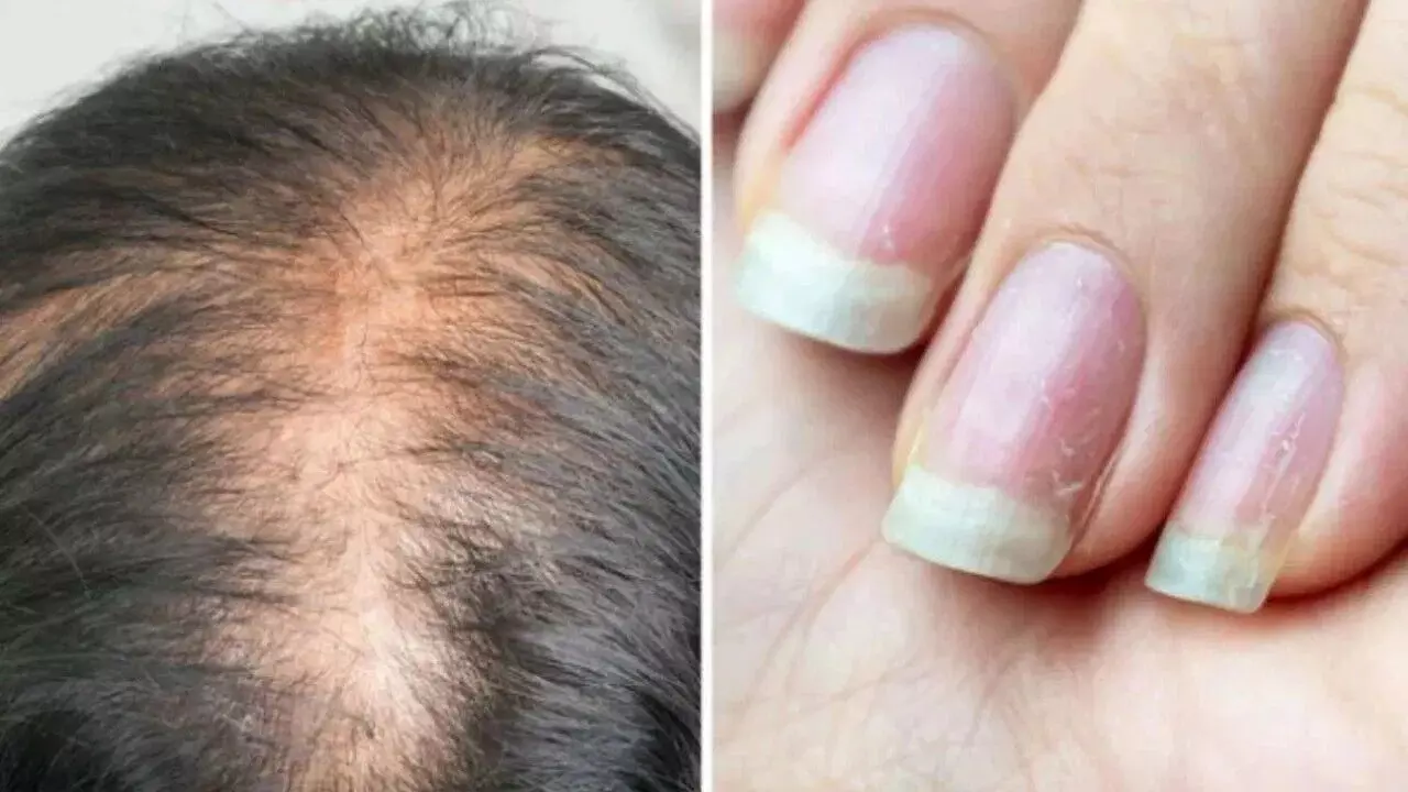 Protein Deficiency in the Body: శరీరంలో ప్రోటీన్ తగ్గుతోందని చెప్పే 6 హెచ్చరికలు.. వీటిని నిర్లక్ష్యం చేయొద్దు.. Protein Deficiency in the Body: శరీరంలో ప్రోటీన్ తగ్గుతోందని చెప్పే 6 హెచ్చరికలు.. వీటిని నిర్లక్ష్యం చేయొద్దు..