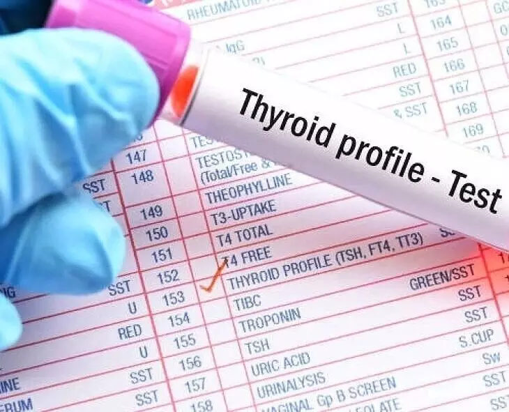 Thyroid Test: థైరాయిడ్ టెస్ట్ ఎప్పుడు చేయించుకోవాలంటే Thyroid Test: థైరాయిడ్ టెస్ట్ ఎప్పుడు చేయించుకోవాలంటే