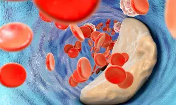 Cholesterol Levels Rise in Winter: శీతాకాలంలో పెరిగే కొలెస్ట్రాల్: మీ ఆరోగ్యం మీ చేతుల్లోనే.. Cholesterol Levels Rise in Winter: శీతాకాలంలో పెరిగే కొలెస్ట్రాల్: మీ ఆరోగ్యం మీ చేతుల్లోనే..