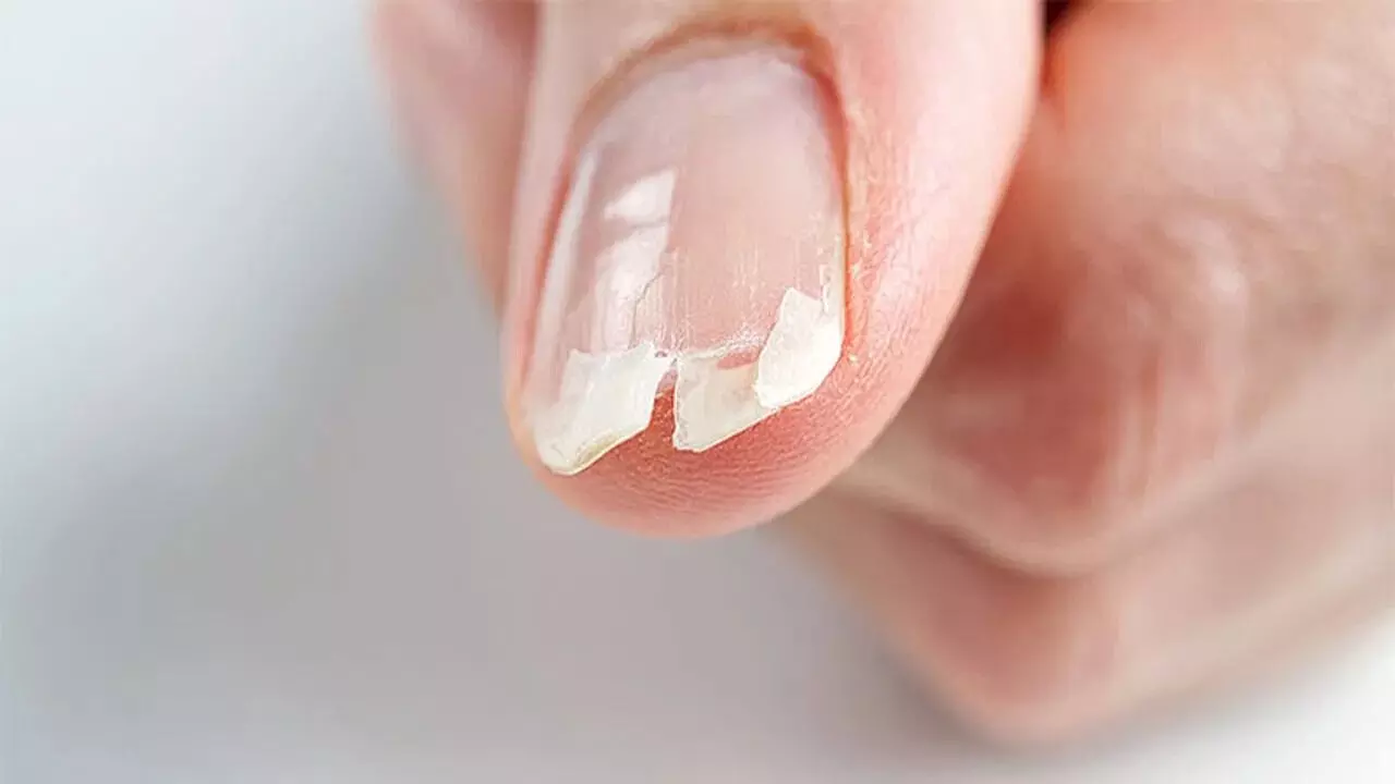 Prevent Your Nails from Breaking: గోర్లు విరిగిపోకుండా ఉండాలంటే ఈ చిట్కాలు ఫాలో కండి Prevent Your Nails from Breaking: గోర్లు విరిగిపోకుండా ఉండాలంటే ఈ చిట్కాలు ఫాలో కండి