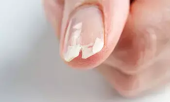 Prevent Your Nails from Breaking: గోర్లు విరిగిపోకుండా ఉండాలంటే ఈ చిట్కాలు ఫాలో కండి Prevent Your Nails from Breaking: గోర్లు విరిగిపోకుండా ఉండాలంటే ఈ చిట్కాలు ఫాలో కండి