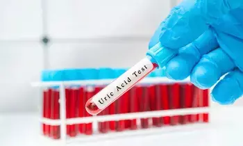 Blood in Urine: మూత్రంలో రక్తం కనిపిస్తోందా? అయితే అది కిడ్నీ క్యాన్సర్ కావచ్చు.. ఎప్పుడు జాగ్రత్తపడాలి? Blood in Urine: మూత్రంలో రక్తం కనిపిస్తోందా? అయితే అది కిడ్నీ క్యాన్సర్ కావచ్చు.. ఎప్పుడు జాగ్రత్తపడాలి?