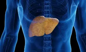 Even Without Alcohol, Liver Can Fail: మద్యం ముట్టకపోయినా లివర్ పని ఖతమ్! తాగని వారిలోనూ పెరుగుతున్న కాలేయ వ్యాధులు.. Even Without Alcohol, Liver Can Fail: మద్యం ముట్టకపోయినా లివర్ పని ఖతమ్! తాగని వారిలోనూ పెరుగుతున్న కాలేయ వ్యాధులు..