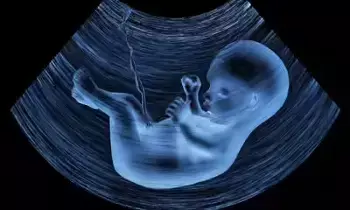 Excess Polyhydramnios in the Womb Dangerous: గర్భంలో ఉమ్మనీరు ఎక్కువగా ఉంటే ప్రమాదమా.? Excess Polyhydramnios in the Womb Dangerous: గర్భంలో ఉమ్మనీరు ఎక్కువగా ఉంటే ప్రమాదమా.?