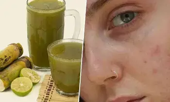 Sugarcane Juice: చెరుకు రసంతో.. మొటిమలకు ఇలా చెక్ పెట్టండి Sugarcane Juice: చెరుకు రసంతో.. మొటిమలకు ఇలా చెక్ పెట్టండి