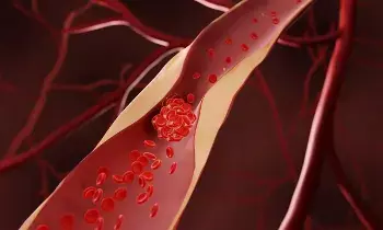 Heart Blockage: గుండెలో అడ్డంకులు ఎందుకు ఏర్పడతాయి..? ఈ లక్షణాలు కనిపిస్తే వెంటనే అలర్ట్ అవ్వండి.. Heart Blockage: గుండెలో అడ్డంకులు ఎందుకు ఏర్పడతాయి..? ఈ లక్షణాలు కనిపిస్తే వెంటనే అలర్ట్ అవ్వండి..