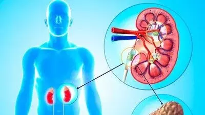 Kidney Stones: కిడ్నీలో రాళ్లు ఉన్నవారు పాలు తాగకూడదా? అసలు నిజం ఇది.. Kidney Stones: కిడ్నీలో రాళ్లు ఉన్నవారు పాలు తాగకూడదా? అసలు నిజం ఇది..