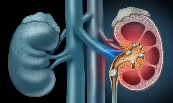 Blood in Urine: మూత్రంలో రక్తం కనిపిస్తోందా? కిడ్నీలో రాళ్లు ఉన్నవారు ఈ పొరపాట్లు అస్సలు చేయకండి Blood in Urine: మూత్రంలో రక్తం కనిపిస్తోందా? కిడ్నీలో రాళ్లు ఉన్నవారు ఈ పొరపాట్లు అస్సలు చేయకండి