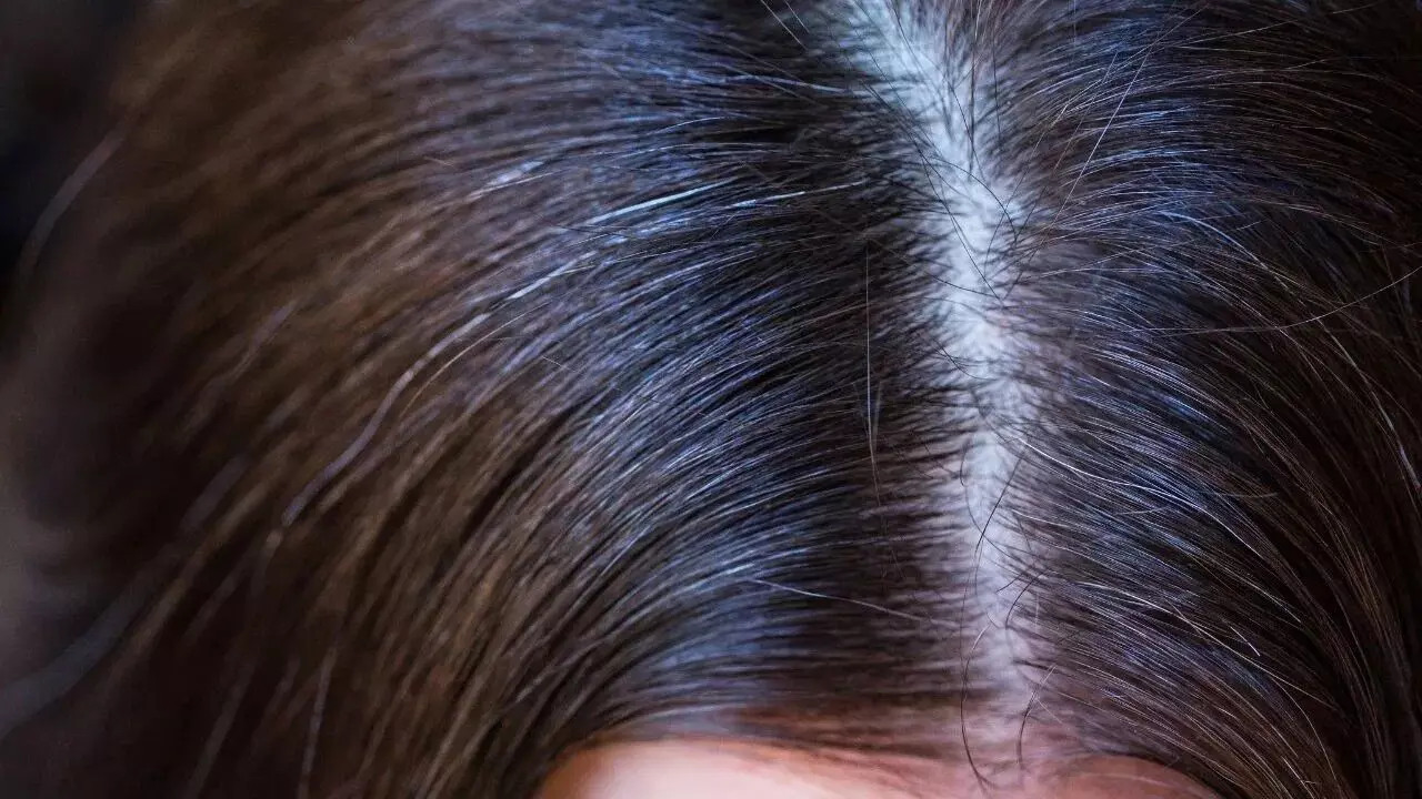 Grey Hair in Children at a Young Age: చిన్న వయసులోనే పిల్లల్లో తెల్ల జుట్టు వస్తోందా? కారణాలు, పరిష్కారాలు ఇవే.. Grey Hair in Children at a Young Age: చిన్న వయసులోనే పిల్లల్లో తెల్ల జుట్టు వస్తోందా? కారణాలు, పరిష్కారాలు ఇవే..