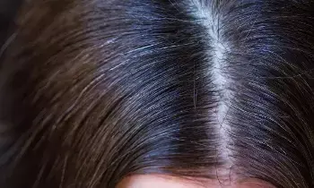Grey Hair in Children at a Young Age: చిన్న వయసులోనే పిల్లల్లో తెల్ల జుట్టు వస్తోందా? కారణాలు, పరిష్కారాలు ఇవే.. Grey Hair in Children at a Young Age: చిన్న వయసులోనే పిల్లల్లో తెల్ల జుట్టు వస్తోందా? కారణాలు, పరిష్కారాలు ఇవే..
