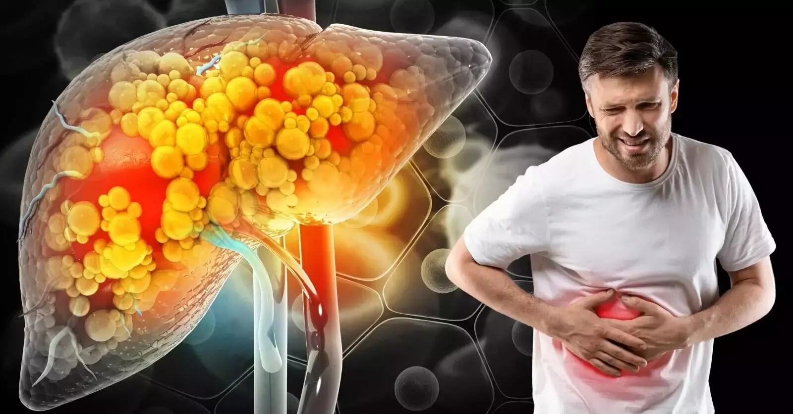 Liver Problems Without Alcohol: మద్యం తాగకపోయినా లివర్ ఖరాబ్ అవుతుందా? షాకింగ్ నిజాలు! Liver Problems Without Alcohol: మద్యం తాగకపోయినా లివర్ ఖరాబ్ అవుతుందా? షాకింగ్ నిజాలు!