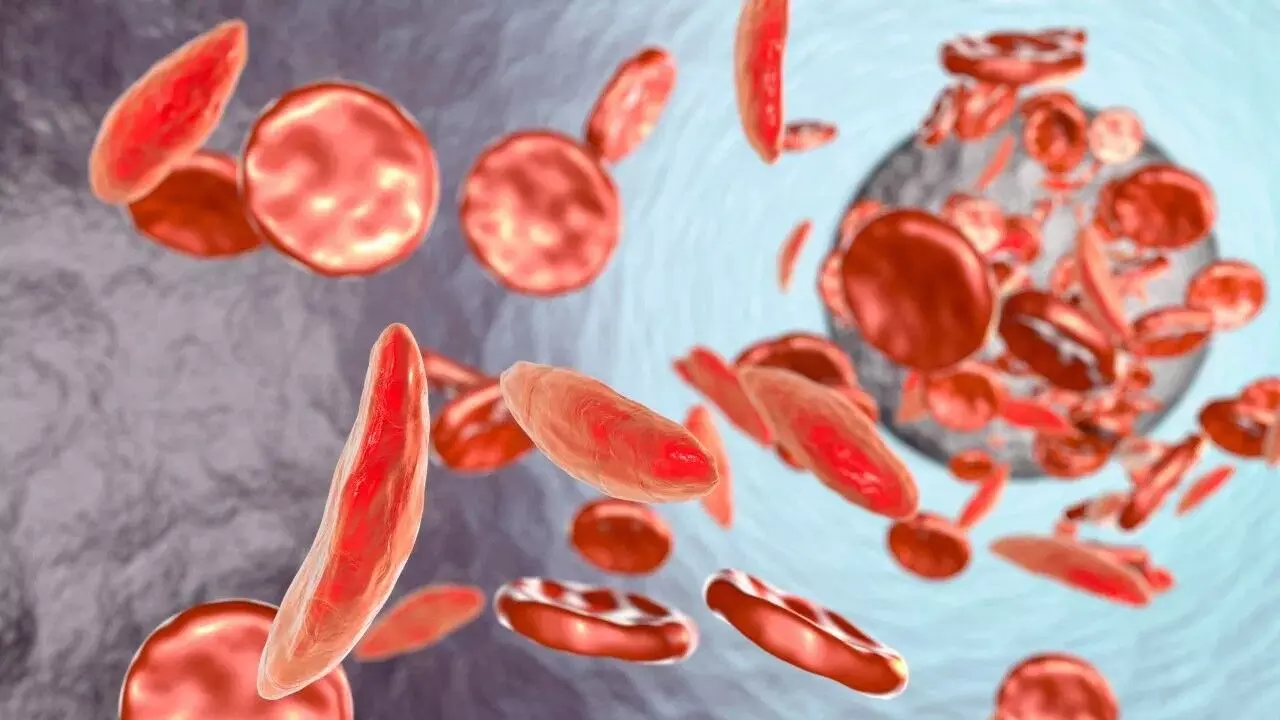 Rising Anemia in Children: పిల్లల్లో పెరుగుతున్న రక్తహీనత.. తల్లిదండ్రులు గమనించాల్సిన డేంజర్ బెల్స్ ఇవే.. Rising Anemia in Children: పిల్లల్లో పెరుగుతున్న రక్తహీనత.. తల్లిదండ్రులు గమనించాల్సిన డేంజర్ బెల్స్ ఇవే..