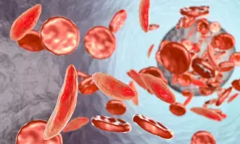 Rising Anemia in Children: పిల్లల్లో పెరుగుతున్న రక్తహీనత.. తల్లిదండ్రులు గమనించాల్సిన డేంజర్ బెల్స్ ఇవే.. Rising Anemia in Children: పిల్లల్లో పెరుగుతున్న రక్తహీనత.. తల్లిదండ్రులు గమనించాల్సిన డేంజర్ బెల్స్ ఇవే..