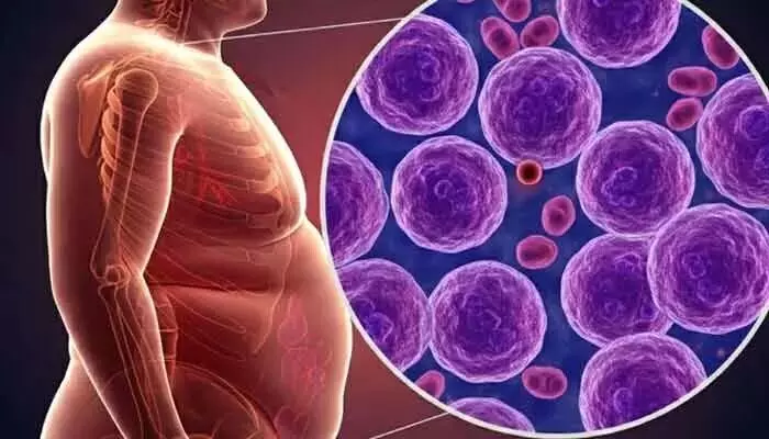 Link Between Obesity and Cancer: బరువుకి, క్యాన్సర్కి లింక్ ఏంటి?..యువతను భయపెడుతున్న కొత్త పరిశోధనలు! Link Between Obesity and Cancer: బరువుకి, క్యాన్సర్కి లింక్ ఏంటి?..యువతను భయపెడుతున్న కొత్త పరిశోధనలు!