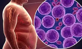 Link Between Obesity and Cancer: బరువుకి, క్యాన్సర్కి లింక్ ఏంటి?..యువతను భయపెడుతున్న కొత్త పరిశోధనలు! Link Between Obesity and Cancer: బరువుకి, క్యాన్సర్కి లింక్ ఏంటి?..యువతను భయపెడుతున్న కొత్త పరిశోధనలు!