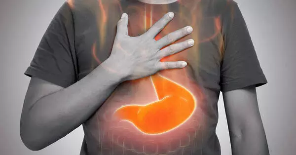 Rising Acidity Problems Among IT Employees and Youth: ఐటీ ఉద్యోగులు, యువతలో పెరుగుతున్న గుండెల్లో మంట.. వంటింటి గదిలోనే ఉంది చెక్ పెట్టే 5 చిట్కాలు.. Rising Acidity Problems Among IT Employees and Youth: ఐటీ ఉద్యోగులు, యువతలో పెరుగుతున్న గుండెల్లో మంట.. వంటింటి గదిలోనే ఉంది చెక్ పెట్టే 5 చిట్కాలు..