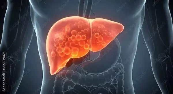 Fatty Liver Problems: ప్రతి ముగ్గురిలో ఒకరికి ఫ్యాటీ లివర్ సమస్య.. కేవలం 3 నెలల్లో సహజంగా ఎలా తగ్గించుకోవాలో తెలుసా..? Fatty Liver Problems: ప్రతి ముగ్గురిలో ఒకరికి ఫ్యాటీ లివర్ సమస్య.. కేవలం 3 నెలల్లో సహజంగా ఎలా తగ్గించుకోవాలో తెలుసా..?