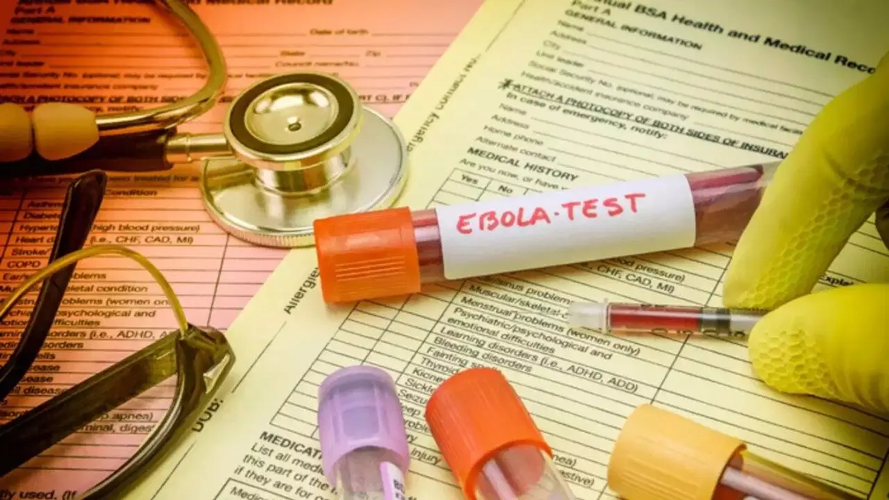 Global Concern Over Ebola: ప్రపంచవ్యాప్తంగా ఎబోలా గుబులు.. అస్సలు నిర్లక్ష్యం చేయకూడని 7 తొలి లక్షణాలు ఇవే.. Global Concern Over Ebola: ప్రపంచవ్యాప్తంగా ఎబోలా గుబులు.. అస్సలు నిర్లక్ష్యం చేయకూడని 7 తొలి లక్షణాలు ఇవే..