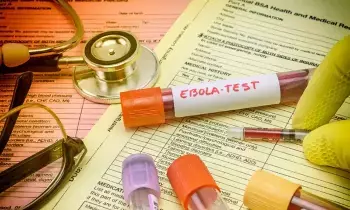 Global Concern Over Ebola: ప్రపంచవ్యాప్తంగా ఎబోలా గుబులు.. అస్సలు నిర్లక్ష్యం చేయకూడని 7 తొలి లక్షణాలు ఇవే.. Global Concern Over Ebola: ప్రపంచవ్యాప్తంగా ఎబోలా గుబులు.. అస్సలు నిర్లక్ష్యం చేయకూడని 7 తొలి లక్షణాలు ఇవే..