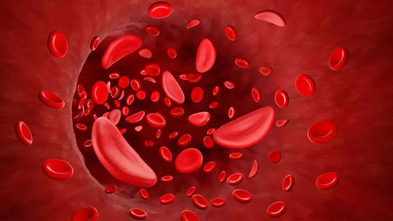 Blood Group Affect How Much Heat You Feel: రక్త గ్రూప్ను బట్టి వేడి ఎక్కువగా అనిపిస్తుందా? అసలు నిజాలు వెల్లడించిన నిపుణులు.. Blood Group Affect How Much Heat You Feel: రక్త గ్రూప్ను బట్టి వేడి ఎక్కువగా అనిపిస్తుందా? అసలు నిజాలు వెల్లడించిన నిపుణులు..