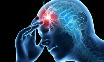 Frequent Migraines:  పదేపదే వచ్చే మైగ్రేన్ తలనొప్పి.. గుండె జబ్బులకు ముందస్తు సంకేతమా?