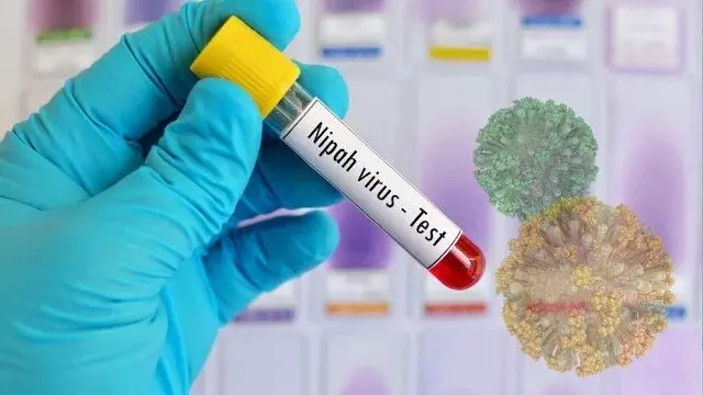 Nipah Virus Scare: నిపా వైరస్ కలకలం: కేరళ - తమిళనాడు - కర్ణాటక సరిహద్దుల్లో హై అలర్ట్.. Nipah Virus Scare: నిపా వైరస్ కలకలం: కేరళ - తమిళనాడు - కర్ణాటక సరిహద్దుల్లో హై అలర్ట్..