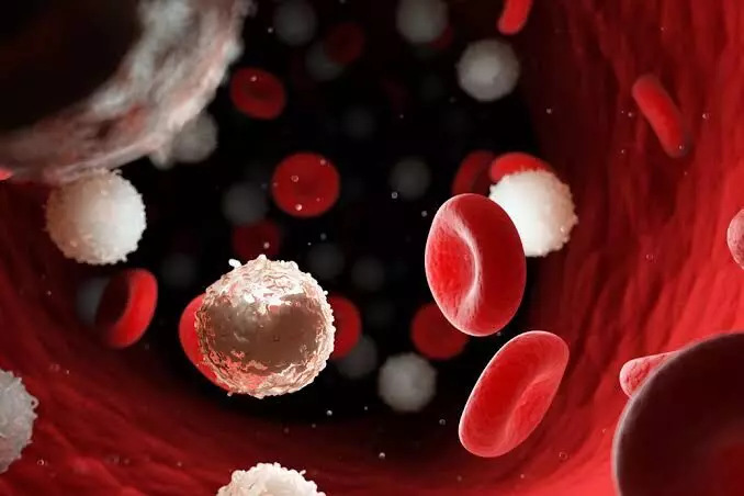 Thalassemia Dangerous: థలసేమియా ప్రమాదకరమా? పెళ్లి, గర్భధారణకు ముందే పరీక్షలు ఎందుకు ముఖ్యం? Thalassemia Dangerous: థలసేమియా ప్రమాదకరమా? పెళ్లి, గర్భధారణకు ముందే పరీక్షలు ఎందుకు ముఖ్యం?