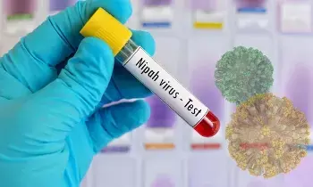 Nipah Virus Scare: నిపా వైరస్ కలకలం: కేరళ - తమిళనాడు - కర్ణాటక సరిహద్దుల్లో హై అలర్ట్.. Nipah Virus Scare: నిపా వైరస్ కలకలం: కేరళ - తమిళనాడు - కర్ణాటక సరిహద్దుల్లో హై అలర్ట్..