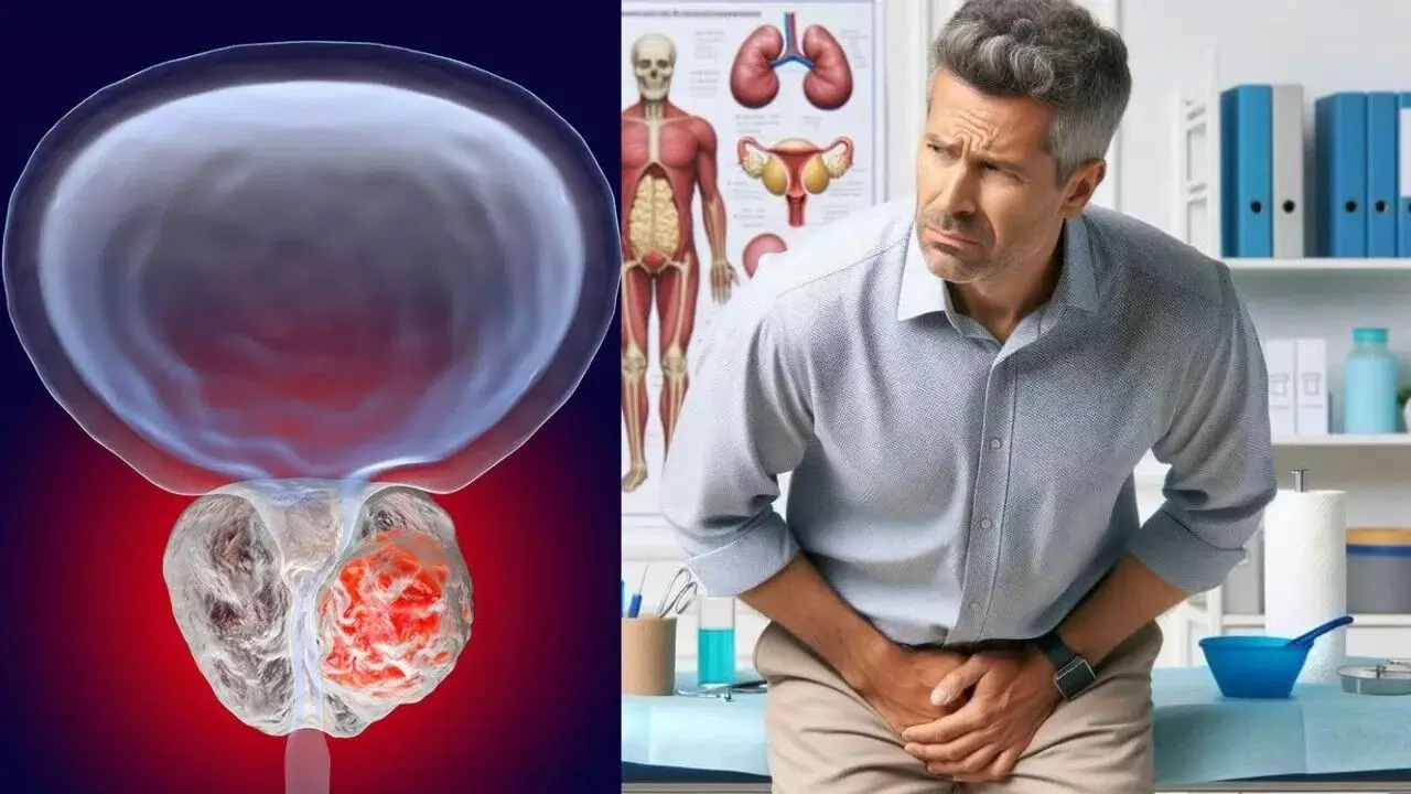 Prostate Cancer: పురుషులలో నిశ్శబ్దంగా పెరిగే ప్రోస్టేట్ క్యాన్సర్.. ఈ 3 లక్షణాలను అస్సలు నిర్లక్ష్యం చేయకండి.. Prostate Cancer: పురుషులలో నిశ్శబ్దంగా పెరిగే ప్రోస్టేట్ క్యాన్సర్.. ఈ 3 లక్షణాలను అస్సలు నిర్లక్ష్యం చేయకండి..