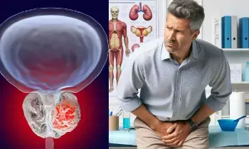 Prostate Cancer: పురుషులలో నిశ్శబ్దంగా పెరిగే ప్రోస్టేట్ క్యాన్సర్.. ఈ 3 లక్షణాలను అస్సలు నిర్లక్ష్యం చేయకండి.. Prostate Cancer: పురుషులలో నిశ్శబ్దంగా పెరిగే ప్రోస్టేట్ క్యాన్సర్.. ఈ 3 లక్షణాలను అస్సలు నిర్లక్ష్యం చేయకండి..
