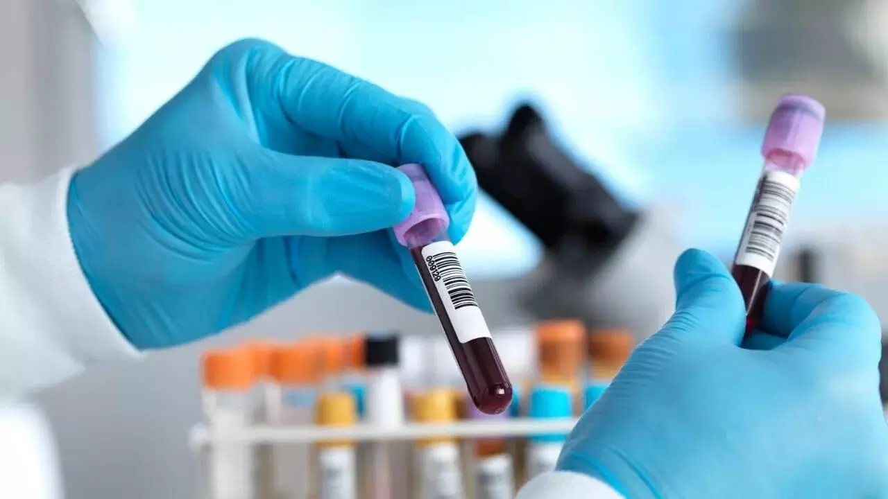 Medical Breakthrough: వైద్య రంగంలో సంచలనం.. భారత్లోకి షీల్డ్ ఎంసీడీ బ్లడ్ టెస్ట్.. ఒకే ఒక్క పరీక్షతో 10 రకాల క్యాన్సర్లకు చెక్.. Medical Breakthrough: వైద్య రంగంలో సంచలనం.. భారత్లోకి షీల్డ్ ఎంసీడీ బ్లడ్ టెస్ట్.. ఒకే ఒక్క పరీక్షతో 10 రకాల క్యాన్సర్లకు చెక్..