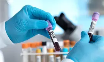 Medical Breakthrough: వైద్య రంగంలో సంచలనం.. భారత్లోకి షీల్డ్ ఎంసీడీ బ్లడ్ టెస్ట్.. ఒకే ఒక్క పరీక్షతో 10 రకాల క్యాన్సర్లకు చెక్.. Medical Breakthrough: వైద్య రంగంలో సంచలనం.. భారత్లోకి షీల్డ్ ఎంసీడీ బ్లడ్ టెస్ట్.. ఒకే ఒక్క పరీక్షతో 10 రకాల క్యాన్సర్లకు చెక్..
