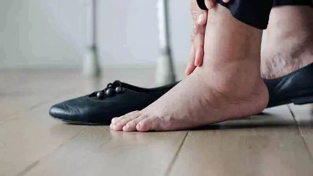 Body Swelling: శరీరంలో వాపులు వస్తున్నాయా? లైట్ తీసుకోకండి.. ఆ 5 ప్రమాదకరమైన రోగాలకు సంకేతం కావచ్చు.. Body Swelling: శరీరంలో వాపులు వస్తున్నాయా? లైట్ తీసుకోకండి.. ఆ 5 ప్రమాదకరమైన రోగాలకు సంకేతం కావచ్చు..