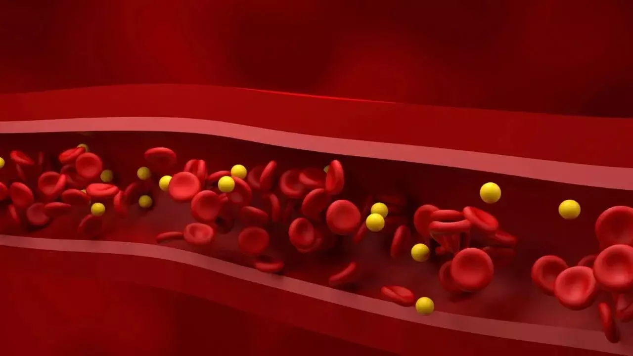 Could High Cholesterol Be Causing Your Back Pain: వెన్నునొప్పికి కారణం హై కొలెస్ట్రాలా? నిర్లక్ష్యం చేయకూడని సరికొత్త ఆరోగ్య హెచ్చరిక.. Could High Cholesterol Be Causing Your Back Pain: వెన్నునొప్పికి కారణం హై కొలెస్ట్రాలా? నిర్లక్ష్యం చేయకూడని సరికొత్త ఆరోగ్య హెచ్చరిక..