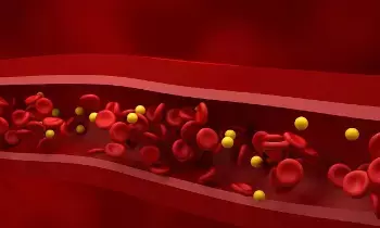 Could High Cholesterol Be Causing Your Back Pain: వెన్నునొప్పికి కారణం హై కొలెస్ట్రాలా? నిర్లక్ష్యం చేయకూడని సరికొత్త ఆరోగ్య హెచ్చరిక.. Could High Cholesterol Be Causing Your Back Pain: వెన్నునొప్పికి కారణం హై కొలెస్ట్రాలా? నిర్లక్ష్యం చేయకూడని సరికొత్త ఆరోగ్య హెచ్చరిక..